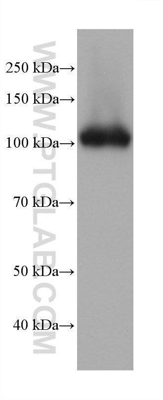 Western Blot (WB) analysis of human placenta tissue using DPP4/CD26 Monoclonal antibody (68383-1-Ig)
