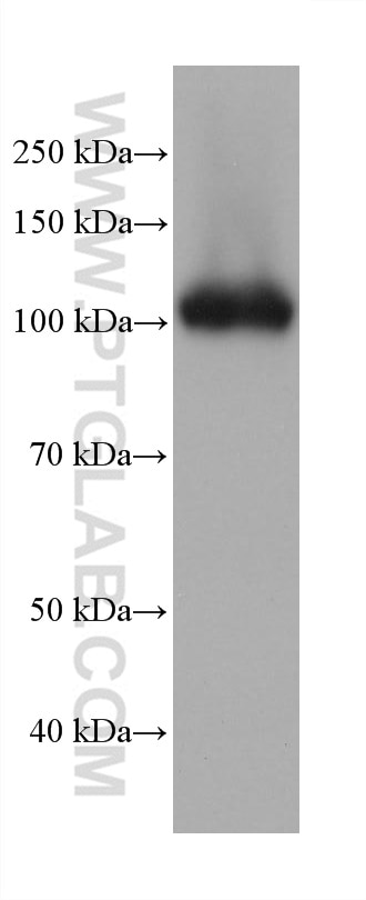 Western Blot (WB) analysis of human placenta tissue using DPP4/CD26 Monoclonal antibody (68383-1-Ig)