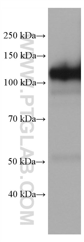 WB analysis of pig kidney using 68383-1-Ig