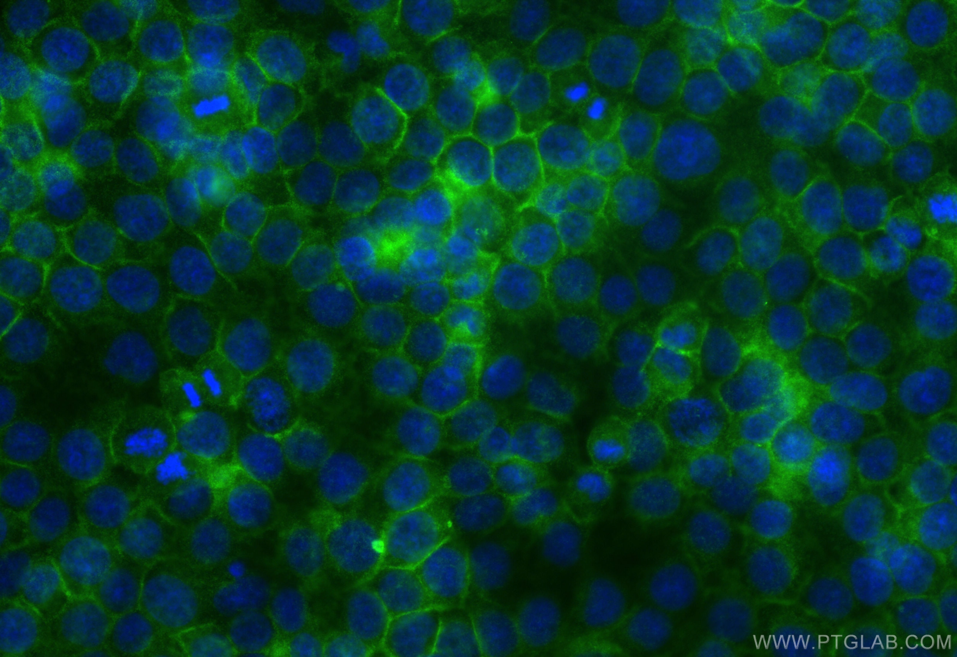Immunofluorescence (IF) / fluorescent staining of HuH-7 cells using DPP4/CD26 Recombinant antibody (84606-6-RR)