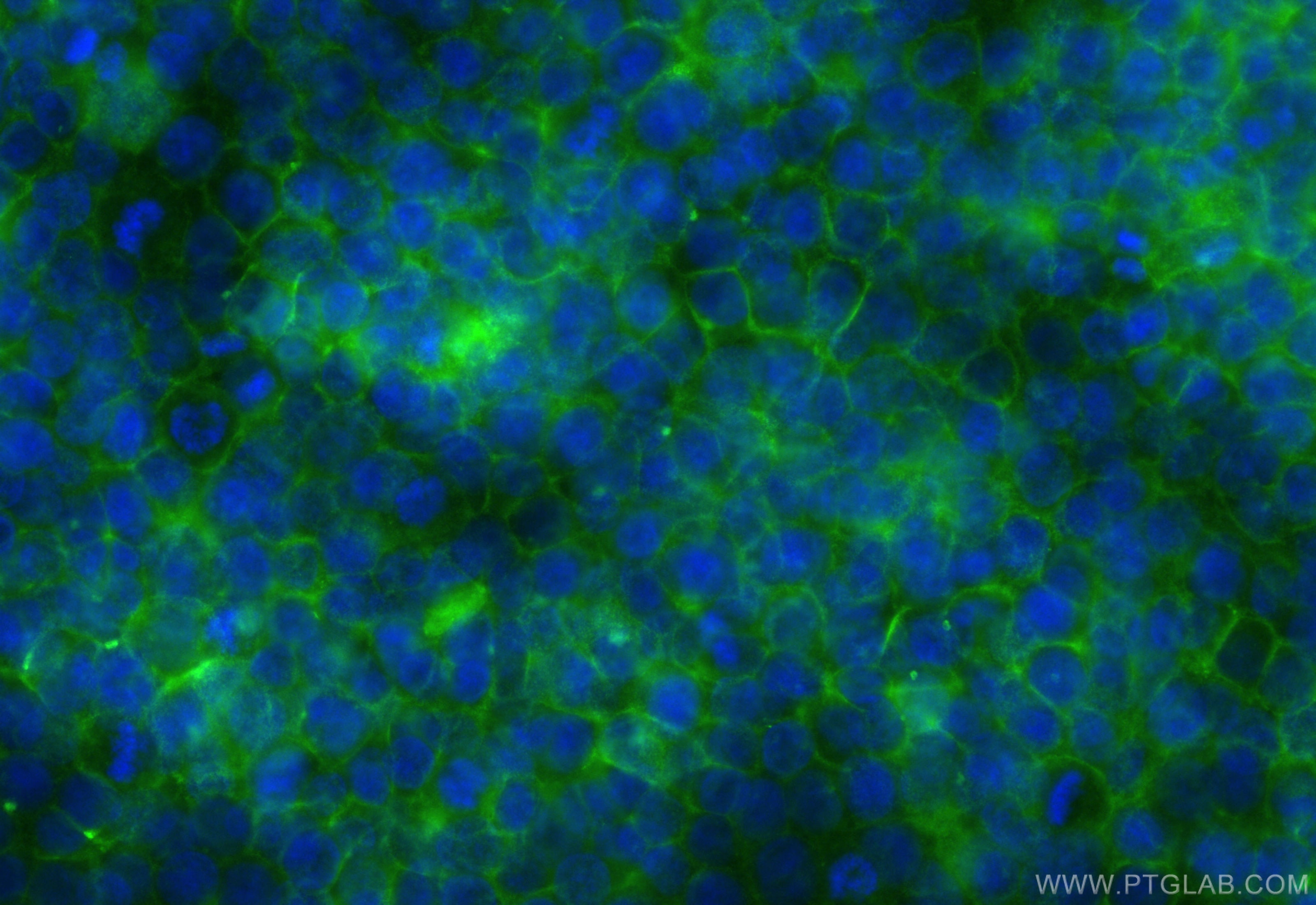 Immunofluorescence (IF) / fluorescent staining of HuH-7 cells using CoraLite® Plus 488-conjugated DPP4/CD26 Recombinan (CL488-84606-6)