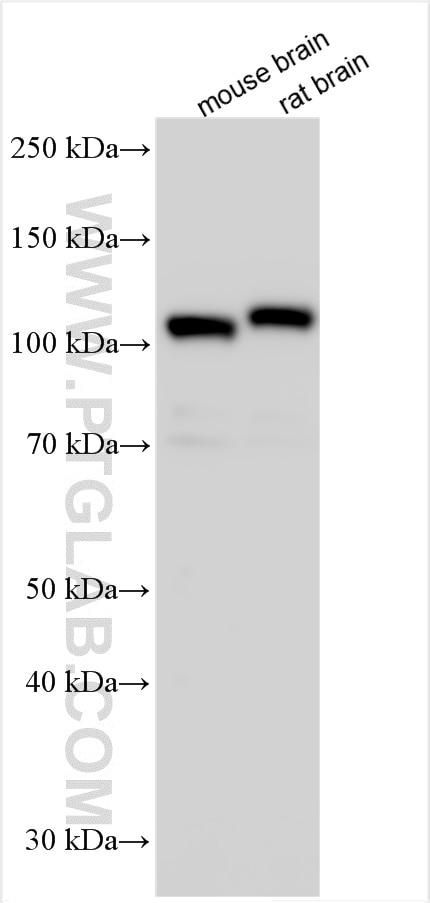 Western Blot (WB) analysis of various lysates using DPP6 Polyclonal antibody (14285-1-AP)