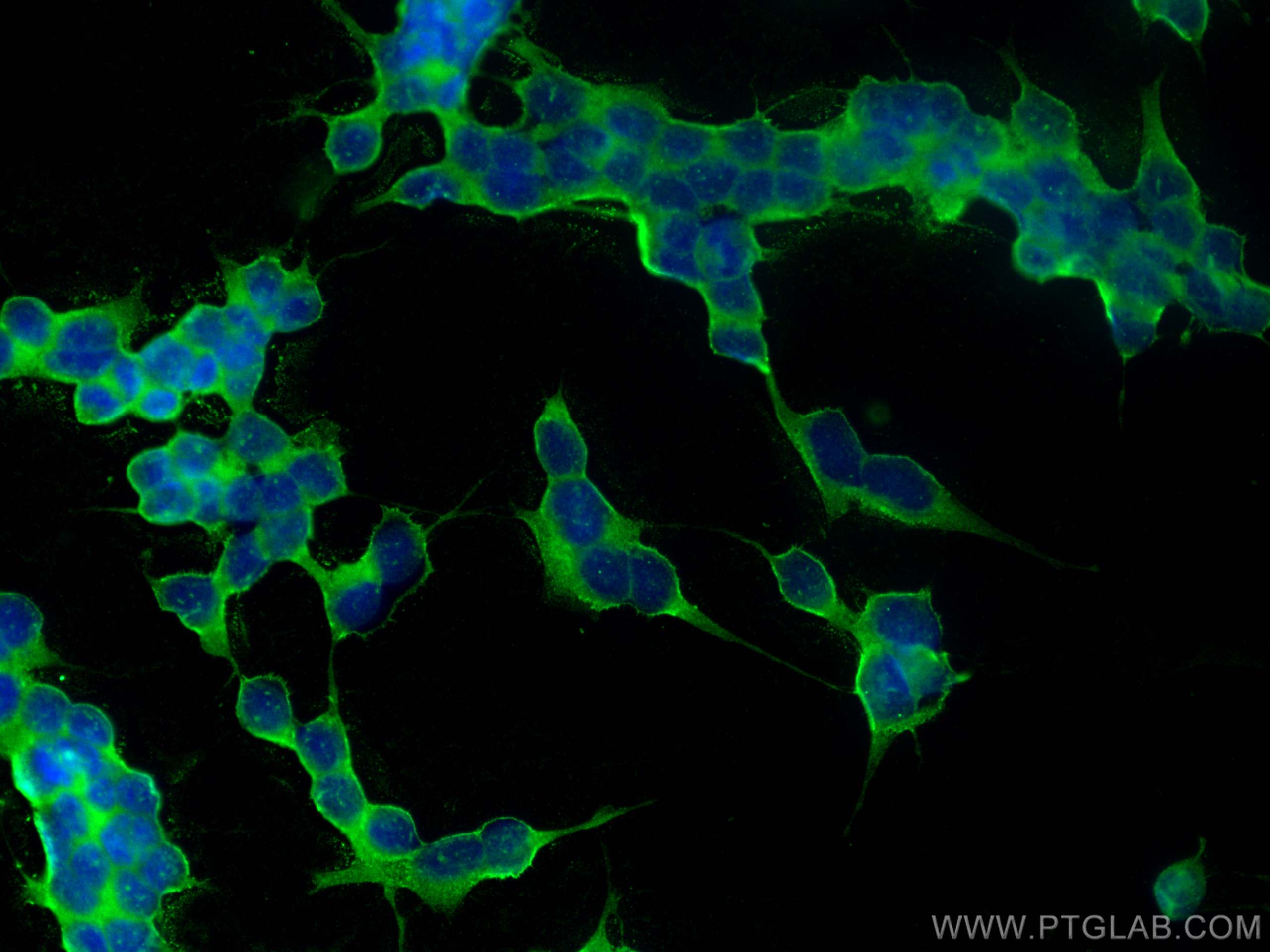 Immunofluorescence (IF) / fluorescent staining of SH-SY5Y cells using DPP6 Polyclonal antibody (28143-1-AP)