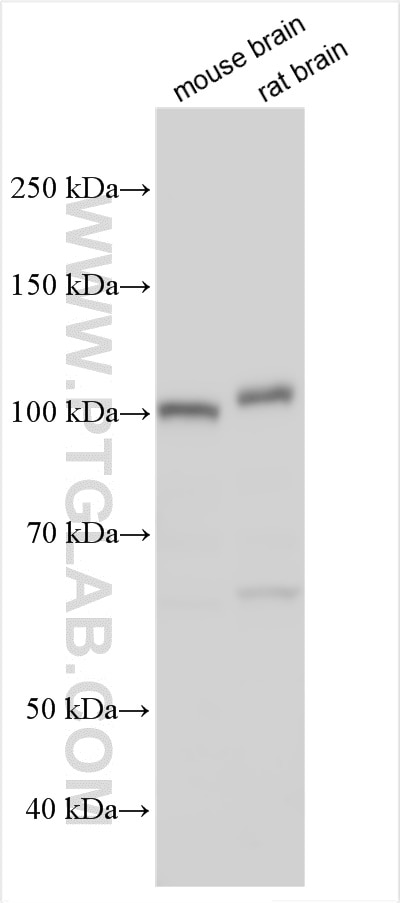 Western Blot (WB) analysis of various lysates using DPP6 Polyclonal antibody (28143-1-AP)