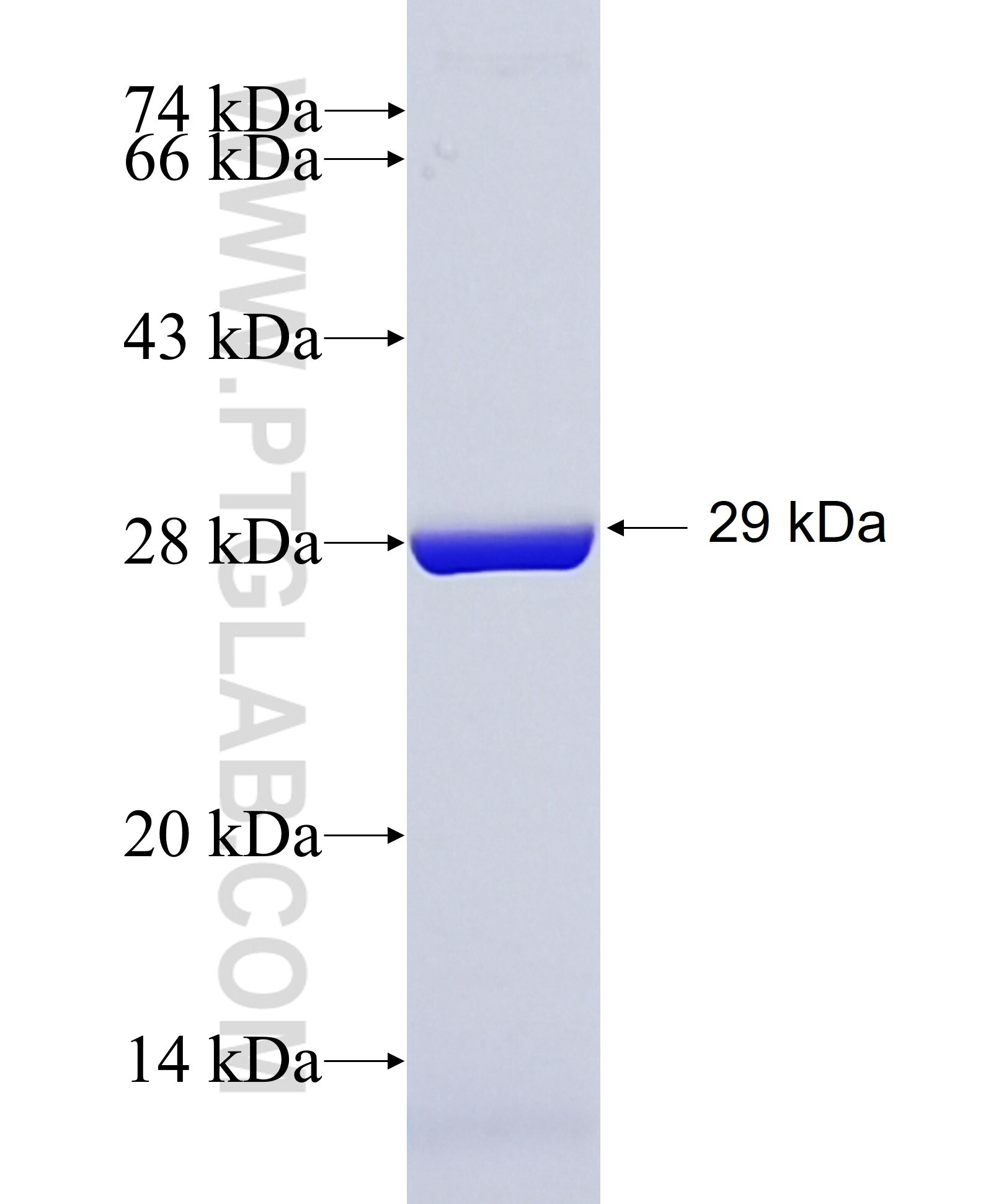 DPP6 fusion protein Ag27338 SDS-PAGE