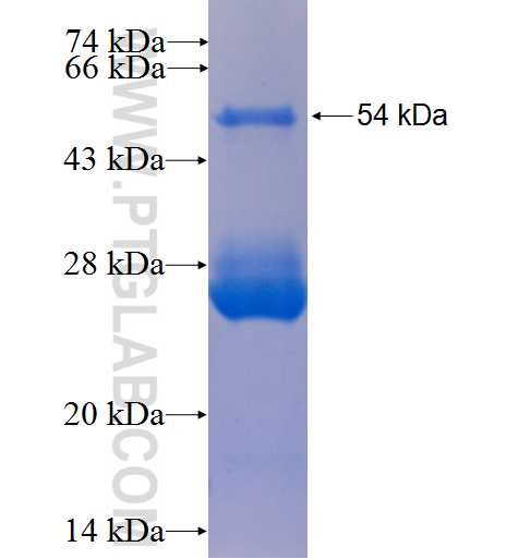 DPP6 fusion protein Ag5584 SDS-PAGE
