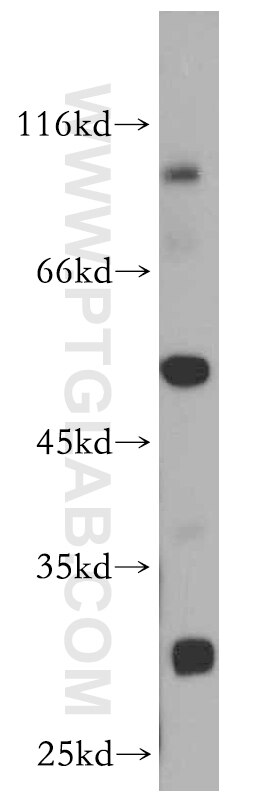 DPP7
