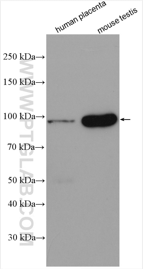 Western Blot (WB) analysis of various lysates using DPP8 Polyclonal antibody (12752-1-AP)