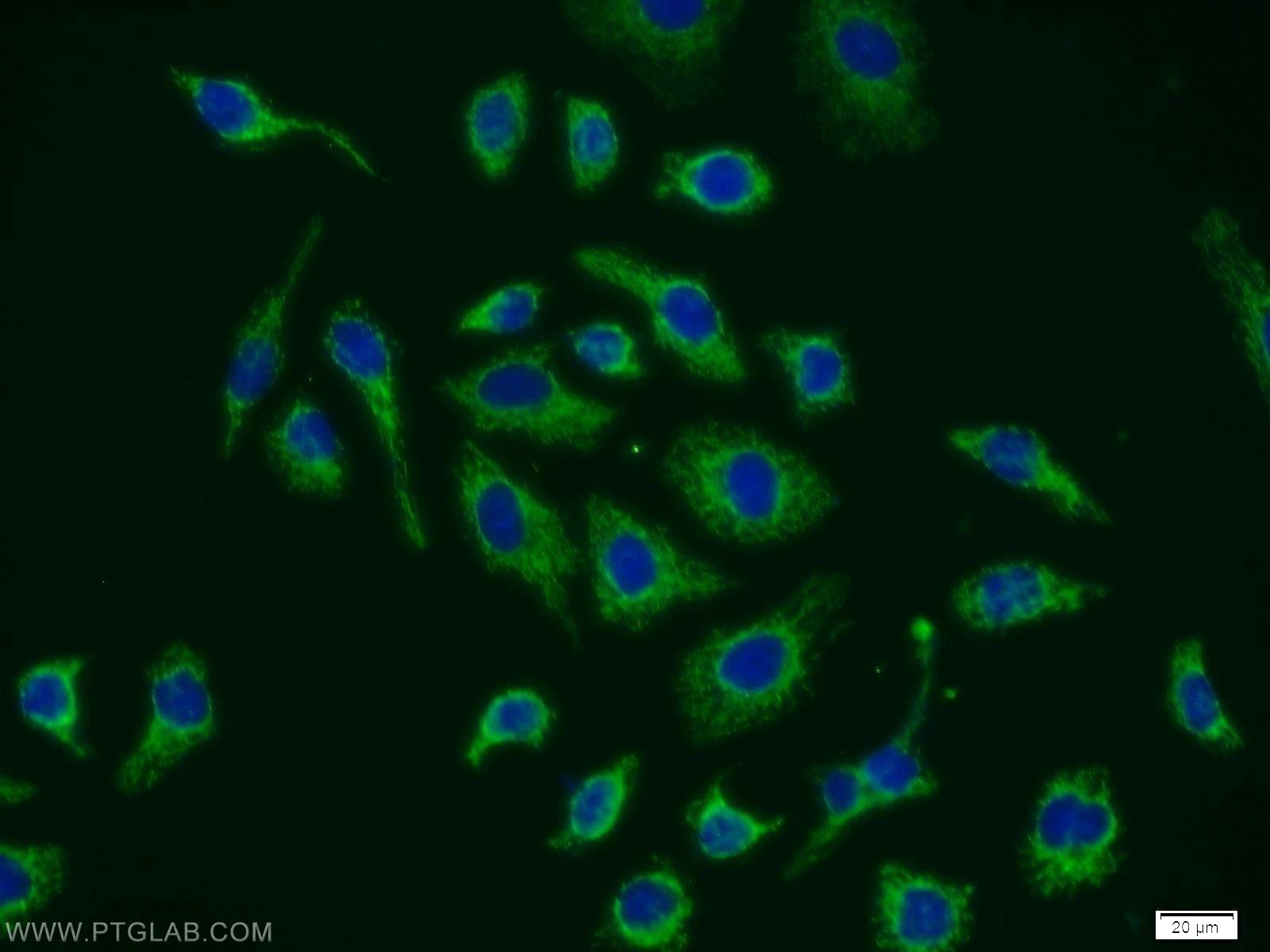 Immunofluorescence (IF) / fluorescent staining of MCF-7 cells using DPP9 Polyclonal antibody (11568-1-AP)