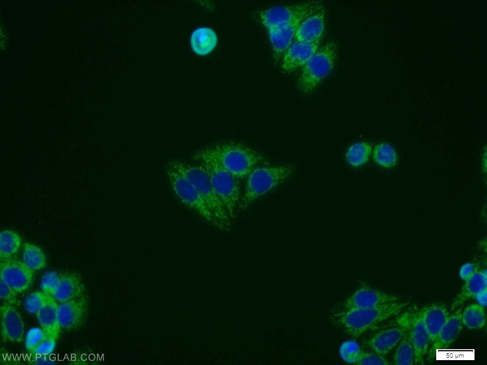 Immunofluorescence (IF) / fluorescent staining of HepG2 cells using DPP9 Polyclonal antibody (11568-1-AP)
