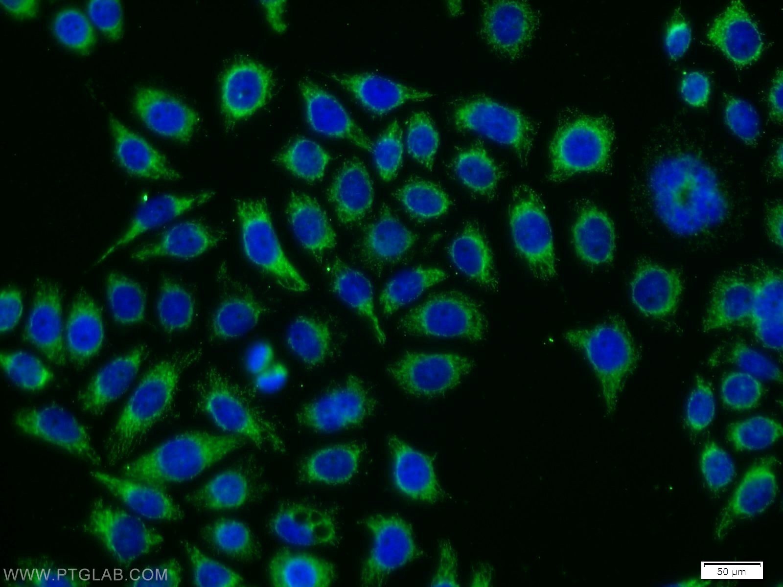 Immunofluorescence (IF) / fluorescent staining of PC-3 cells using DPP9 Polyclonal antibody (11568-1-AP)