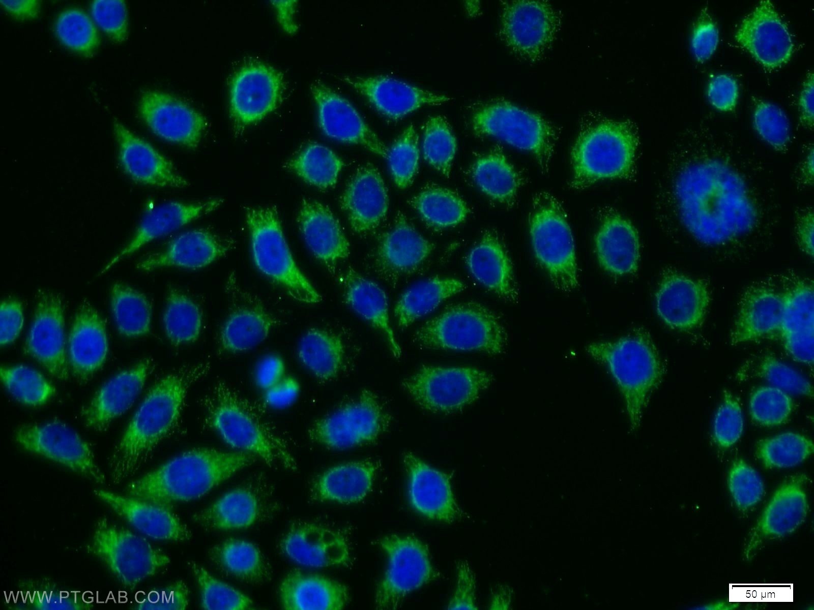 IF Staining of PC-3 using 11568-1-AP