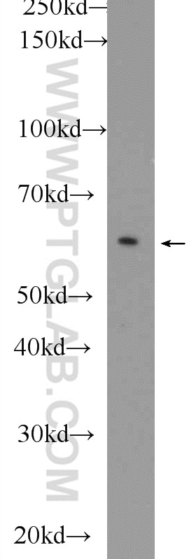 Western Blot (WB) analysis of A2780 cells using DPP9 Polyclonal antibody (11568-1-AP)