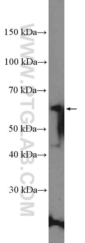 Western Blot (WB) analysis of MCF-7 cells using DPP9 Polyclonal antibody (11568-1-AP)