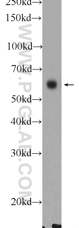 Western Blot (WB) analysis of mouse heart tissue using DPP9 Polyclonal antibody (11568-1-AP)