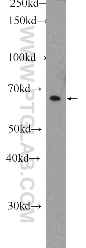Western Blot (WB) analysis of PC-3 cells using DPP9 Polyclonal antibody (11568-1-AP)