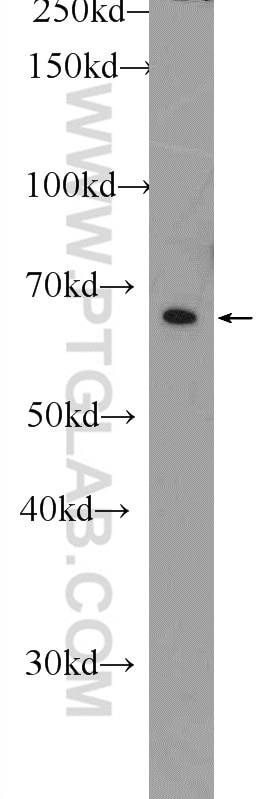 WB analysis of PC-3 using 11568-1-AP