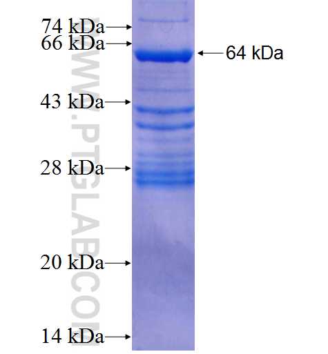 DPP9 fusion protein Ag2145 SDS-PAGE