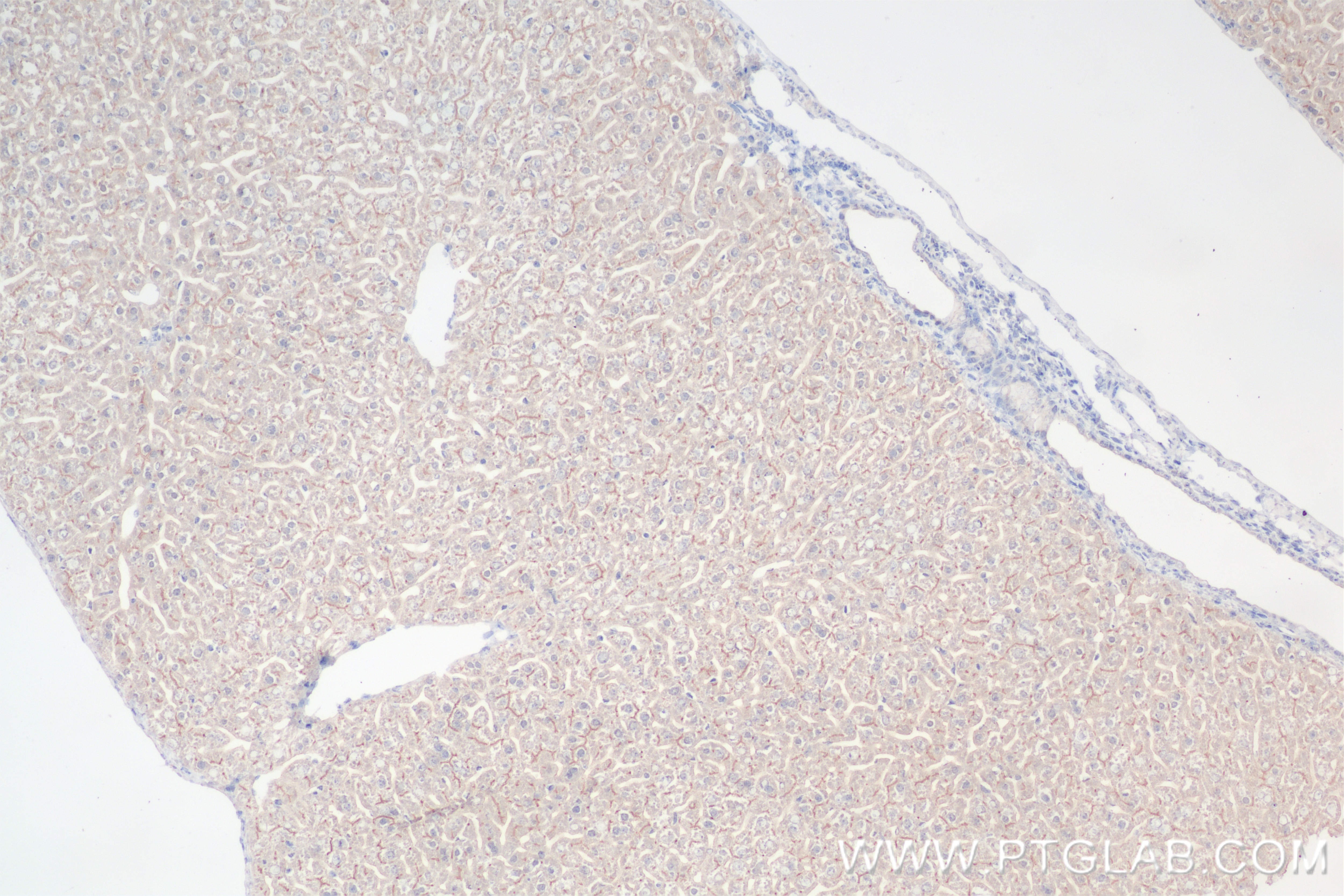 Immunohistochemistry (IHC) staining of mouse liver tissue using DPP4/CD26 Recombinant antibody (85159-3-RR)