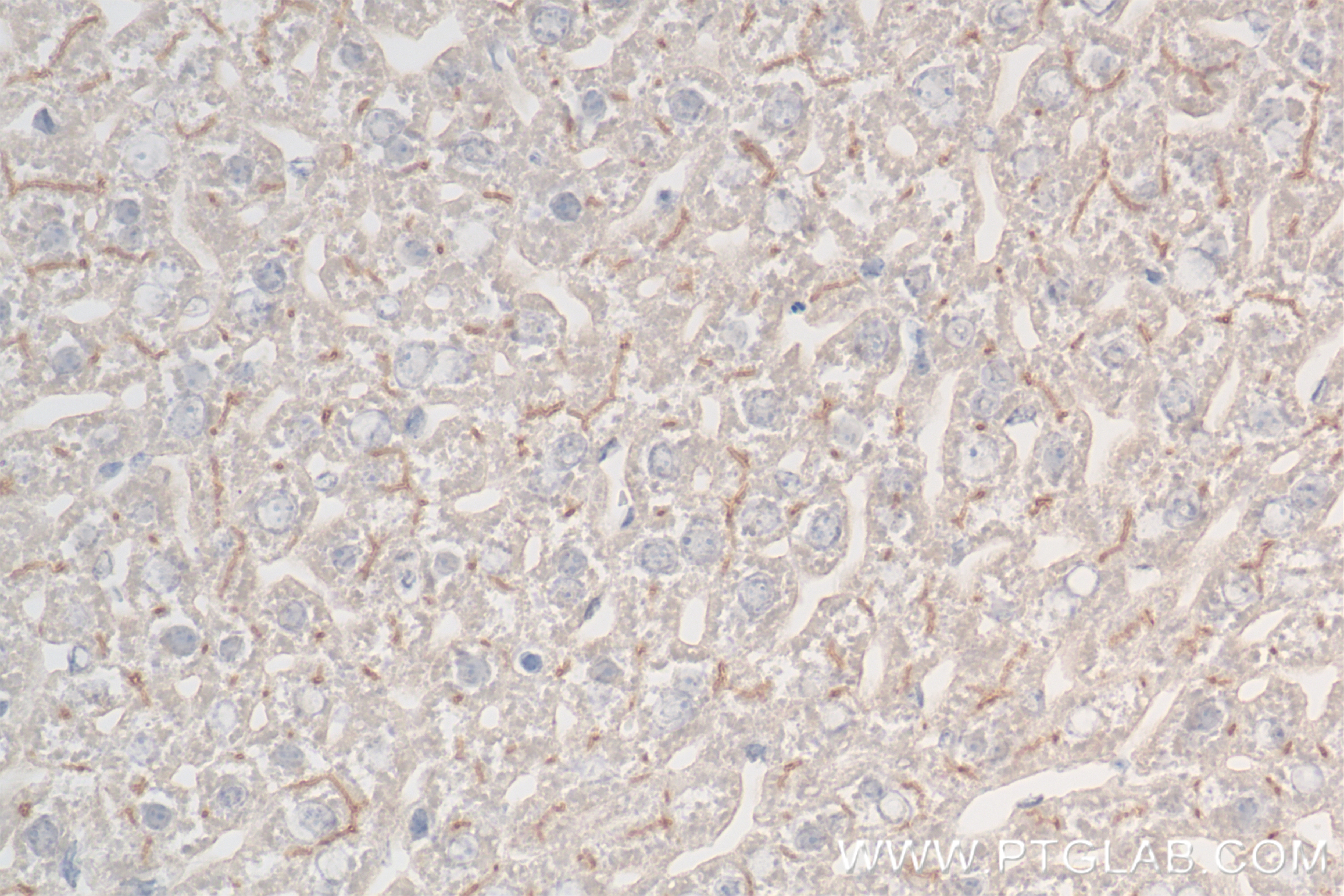Immunohistochemistry (IHC) staining of mouse liver tissue using DPP4/CD26 Recombinant antibody (85159-3-RR)