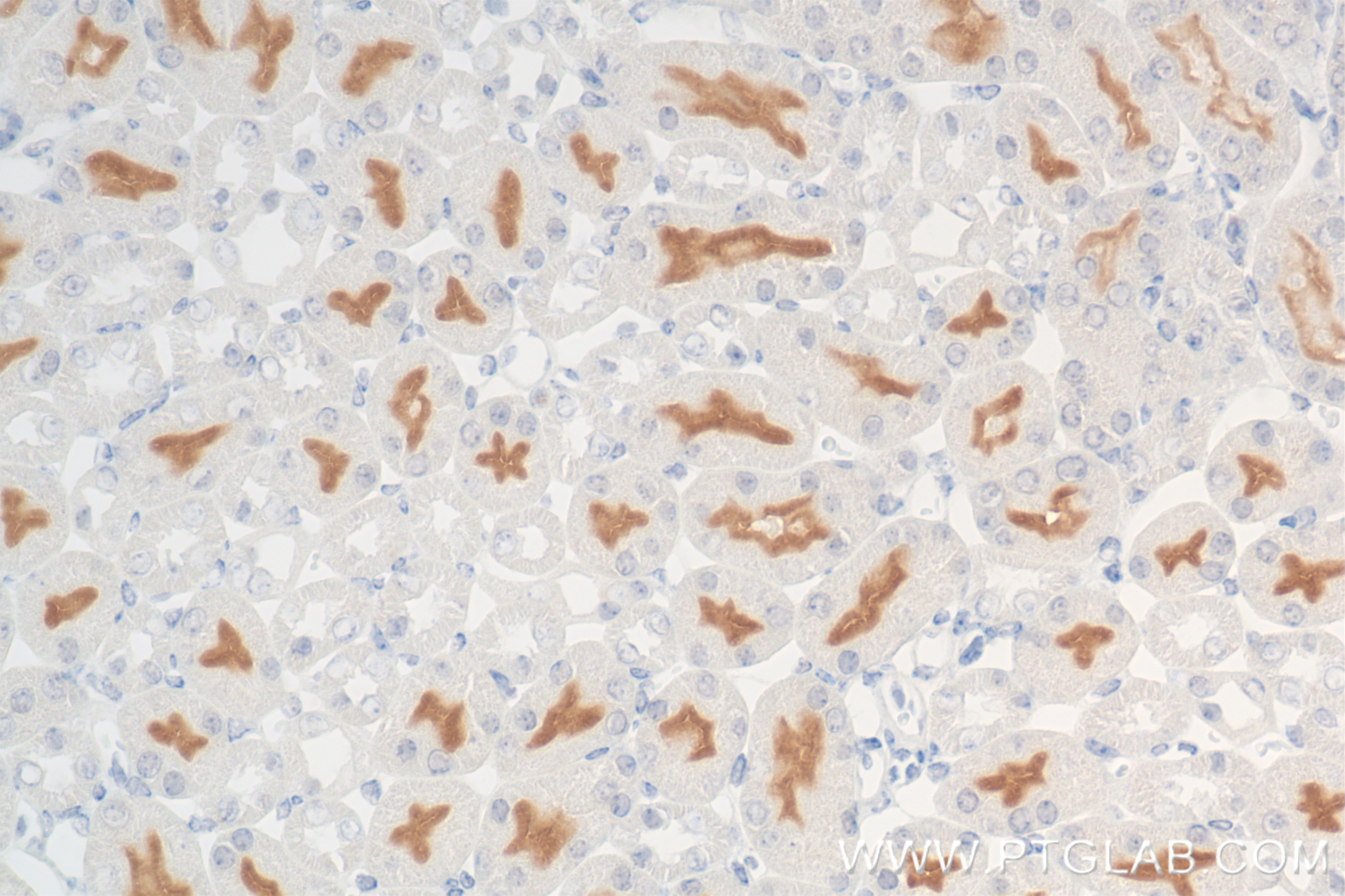 Immunohistochemistry (IHC) staining of mouse kidney tissue using DPP4/CD26 Recombinant antibody (85159-3-RR)