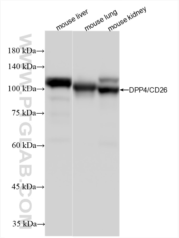 Western Blot (WB) analysis of various lysates using DPP4/CD26 Recombinant antibody (85159-3-RR)