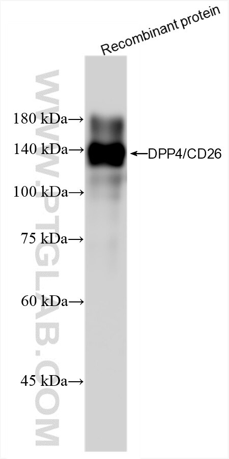 Western Blot (WB) analysis of various lysates using DPP4/CD26 Recombinant antibody (85159-3-RR)