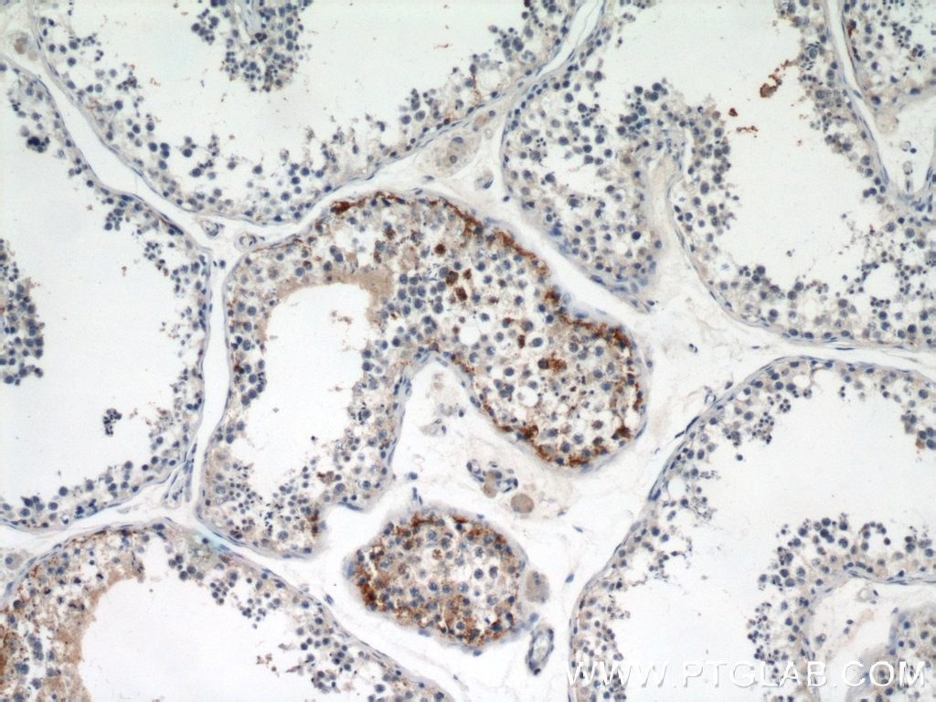 Immunohistochemistry (IHC) staining of human testis tissue using Dermatopontin Polyclonal antibody (10537-1-AP)