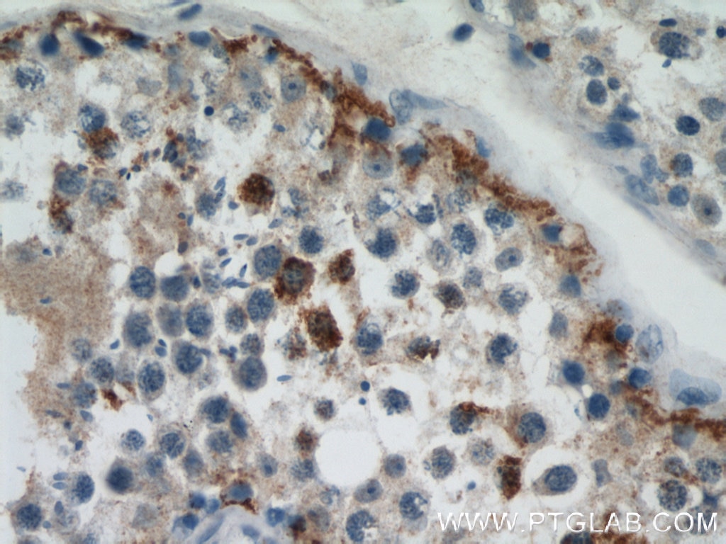 Immunohistochemistry (IHC) staining of human testis tissue using Dermatopontin Polyclonal antibody (10537-1-AP)