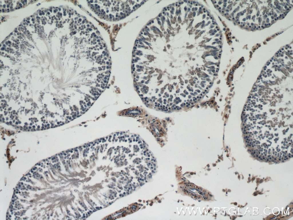 Immunohistochemistry (IHC) staining of rat testis tissue using Dermatopontin Polyclonal antibody (10537-1-AP)