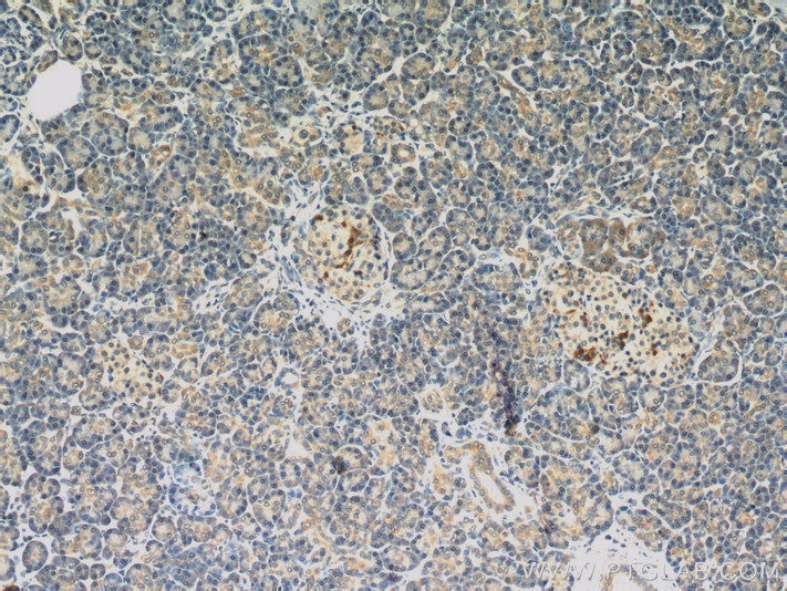 Immunohistochemistry (IHC) staining of human pancreas tissue using Dermatopontin Polyclonal antibody (10537-1-AP)