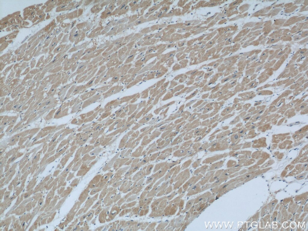 IHC staining of human heart using 10537-1-AP