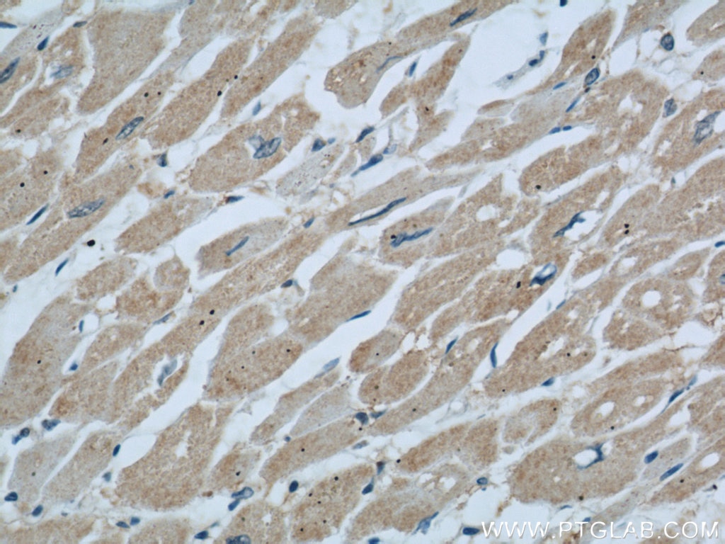 Immunohistochemistry (IHC) staining of human heart tissue using Dermatopontin Polyclonal antibody (10537-1-AP)