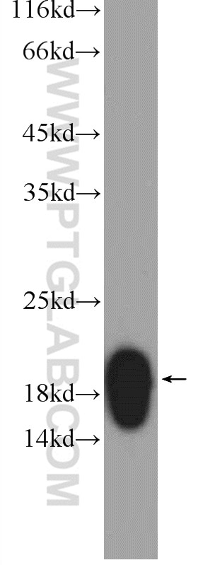 Western Blot (WB) analysis of mouse skin tissue using Dermatopontin Polyclonal antibody (10537-1-AP)