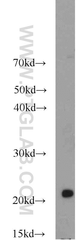 Western Blot (WB) analysis of rat skin tissue using Dermatopontin Polyclonal antibody (10537-1-AP)