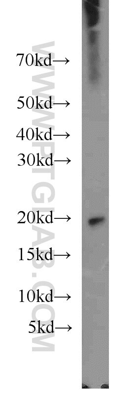 Western Blot (WB) analysis of human skeletal muscle tissue using Dermatopontin Polyclonal antibody (10537-1-AP)