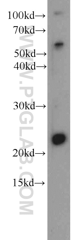 Western Blot (WB) analysis of rat skin tissue using Dermatopontin Polyclonal antibody (14777-1-AP)