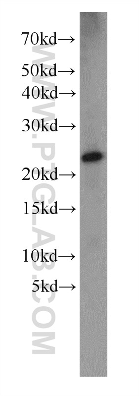 Western Blot (WB) analysis of rat skin tissue using Dermatopontin Polyclonal antibody (14777-1-AP)