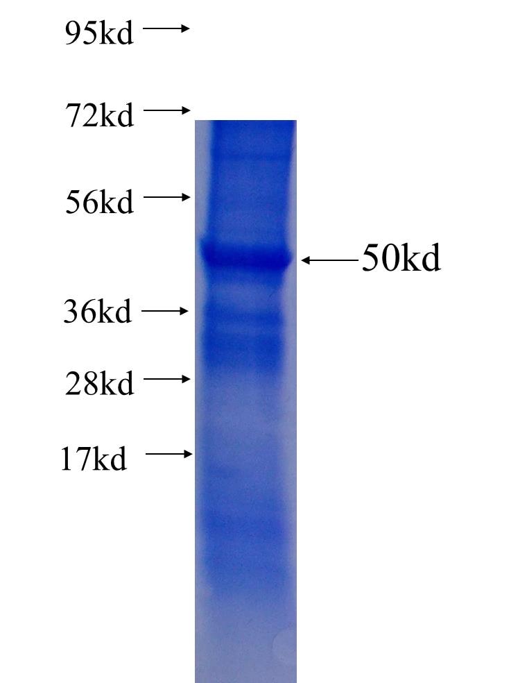 DPT fusion protein Ag0801 SDS-PAGE