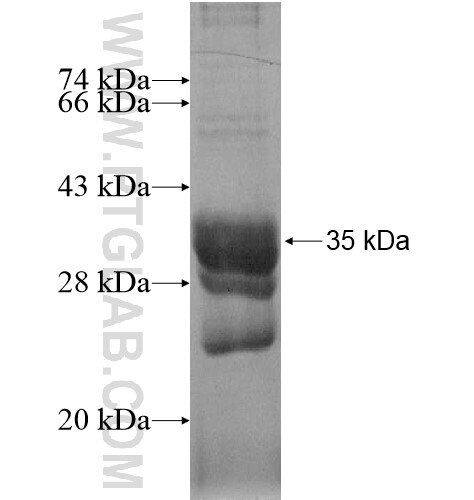 DPY19L3 fusion protein Ag15046 SDS-PAGE