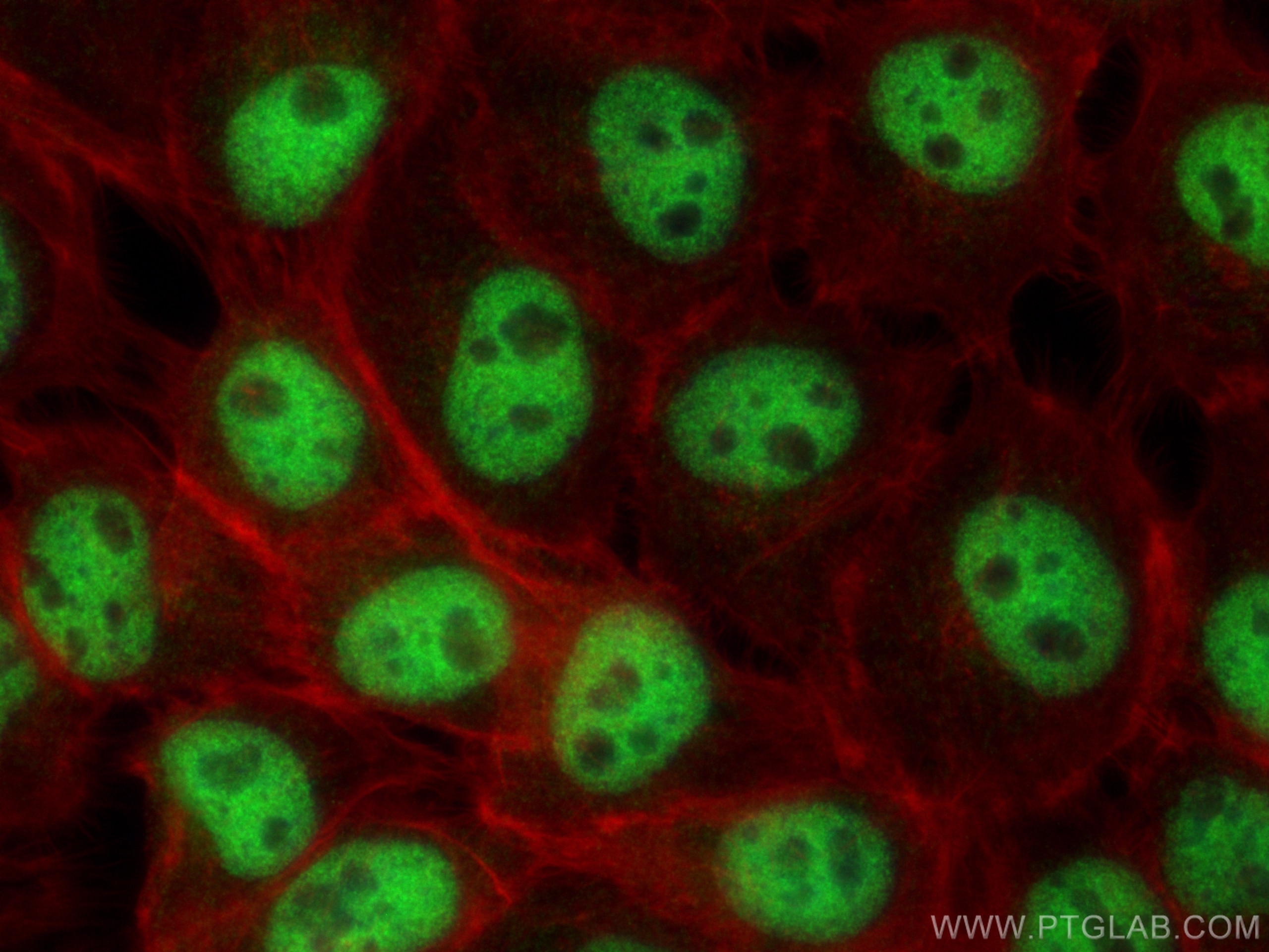 Immunofluorescence (IF) / fluorescent staining of A431 cells using DPY30 Polyclonal antibody (16281-1-AP)