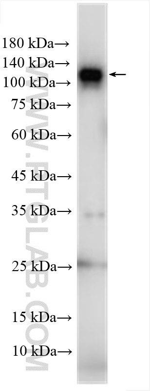 Western Blot (WB) analysis of mouse liver tissue using DPYD Polyclonal antibody (25690-1-AP)