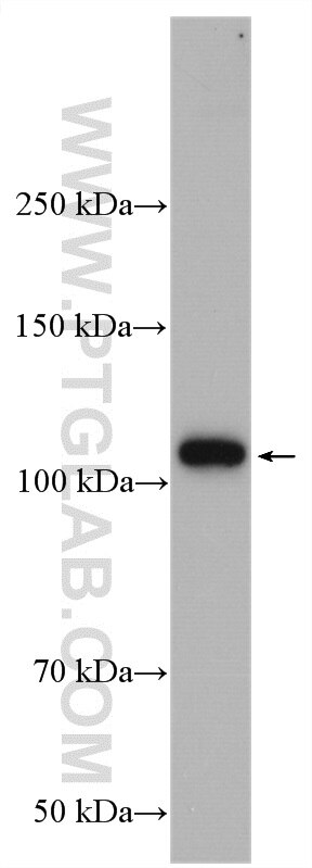 Western Blot (WB) analysis of L02 cells using DPYD Polyclonal antibody (27662-1-AP)