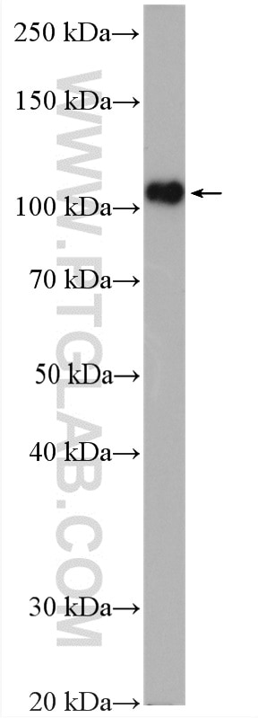 Western Blot (WB) analysis of rat liver tissue using DPYD Polyclonal antibody (27662-1-AP)