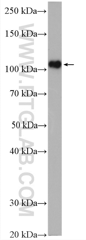 WB analysis of rat liver using 27662-1-AP