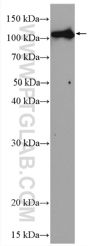 Western Blot (WB) analysis of rat liver tissue using DPYD Polyclonal antibody (27662-1-AP)