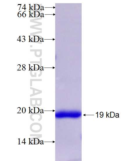 DPYD fusion protein Ag26658 SDS-PAGE