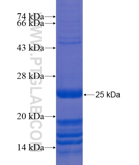DPYD fusion protein Ag20885 SDS-PAGE