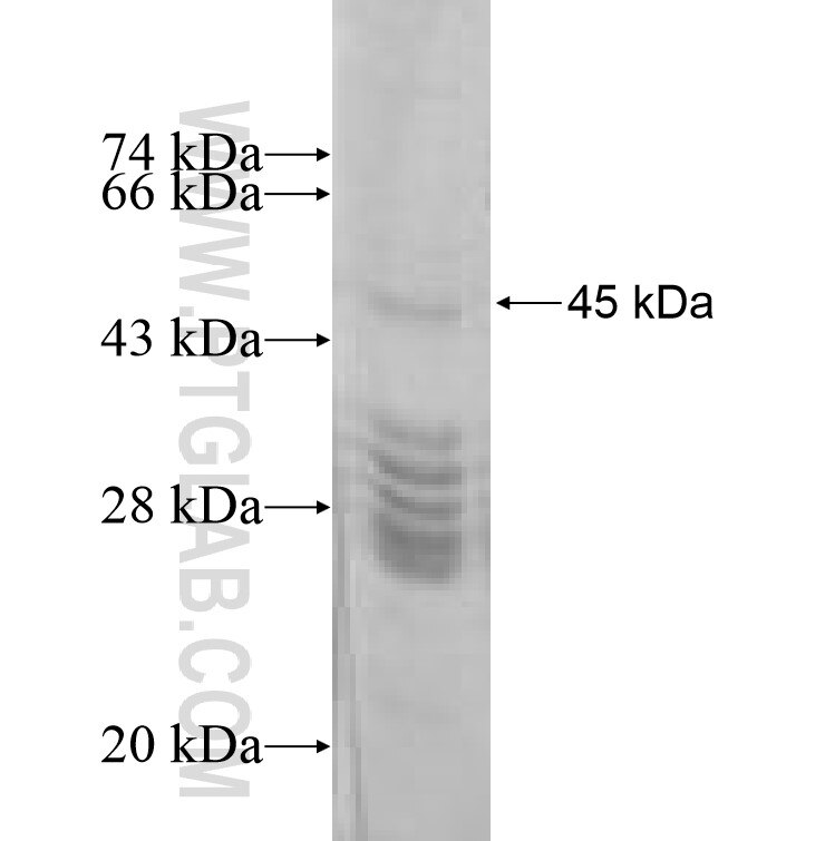 DPYD fusion protein Ag8866 SDS-PAGE