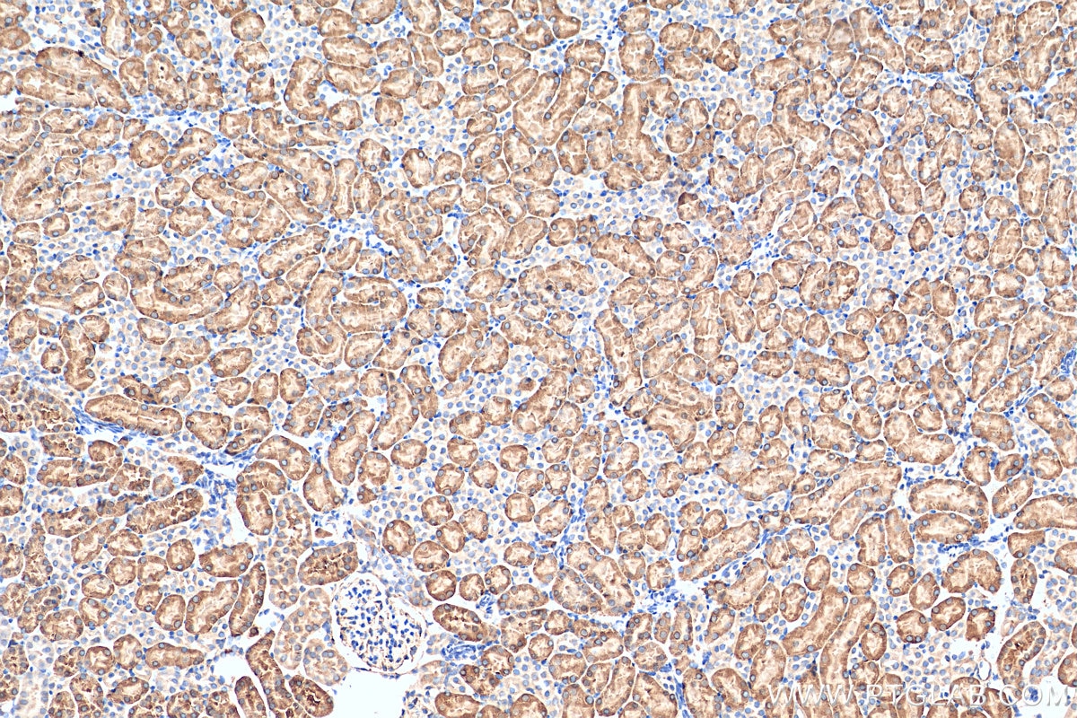 Immunohistochemistry (IHC) staining of mouse kidney tissue using DPYS Polyclonal antibody (13237-1-AP)